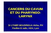 CANCERS DU CAVUM ET DU PHARYNGO-LARYNX … CAS CLINIQUE 2 M. Oua ., 72 ans Otite séro -muqueuse gauche Tumeur bourgeonnante de l ’hémi cavum gauche, englobant l ’orifice tubaire