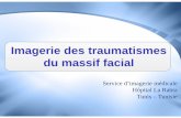 Imagerie des traumatismes du massif facial f - …pe.sfrnet.org/Data/ModuleConsultationPoster/pdf/2010/1/1156fe26-b... · - Fracture de la mandibule - Fracture du sinus frontal. Fracture