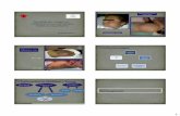 Abordaje por imagen en malformaciones vasculares y ...smri.org.mx/memorias/rad2012/platicas/84.pdf · Abordaje por imagen en malformaciones vasculares y linfáticas en pediatría