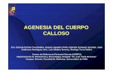 AGENESIA CUERPO CALLOSO - CERPO :: Centro de …cerpo.cl/_items/File_002_00355_0024.pdf · – Quiste interhemisférico. – Anomalías de la migración y organización neuronal cortical