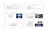 zobrazovacie metódy [Režim kompatibility]) - upjs.sk metódy.pdf · 3 RTG chrbtice • Natívne RTG vyšetrenie chrbtice • A-P, bočná projekcia • Šikmá projekcia – foramina