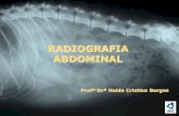RADIOGRAFIA ABDOMINAL - portais.ufg.br · Diafragma Fígado ... Anatomia radiográfica Padrões pulmonares Trato respiratório - TÓRAX. Avaliar estruturas extra-torácicas !!!!!