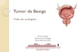 Tumor da Bexiga - core.ac.uk · Exenteração pélvica anterior Derivação urinária Ureterostomia cutânea Ureteroilostomia cutânea –conduto ileal Neobexiga ileal