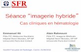 Séance imagerie hybride - cerf.radiologie.fr · Séance “imagerie hybride” Cas cliniques en hématologie Société Française de Radiologie, Cochin, 01/06/2016 Emmanuel Itti