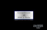 Gonarthrose et IRM 3-Tesla - onclepaul.fronclepaul.fr/wp-content/uploads/2011/07/gonarthrose-et-IRM3T.pdf · -Fréquence corrélée à la sévérité de l’arthrose-Associé aux