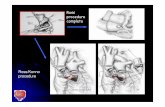 Ross procedure completa · VENTRICOLO UNICO Gruppo Eterogeneo di Malformazioni caratterizzate dalla presenza di un Ventricolo dominante di morfologia Dxo Sn Connessione Atrio -ventricolare