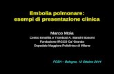 Embolia polmonare: esempi di presentazione clinica - fcsa.it · Sintomi iniziali in 361 pz con embolia polmonare (PS Policlinico) Altri sintomi in 361 casi di EP ( ... Quello che
