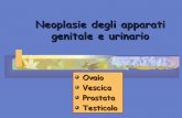 Tumori dell'apparato genitale e urinario · Classificazione istologica Papillare sieroso (50% delle neoplasie epiteliali) Istotipo più comune Endometrioide (20%) occasionalmente