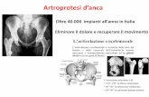 Artroprotesi d’anca - Homepage | DidatticaWEBdidattica.uniroma2.it/assets/uploads/corsi/144507/Artroprotesi... · L’anca (coxa o articolazione coxo-femorale) è una delle più