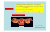 Emoperitoneo (corpo luteo emorragico, rottura di GEU ... · Ascesso tubo-ovarico Peritonite pelvica Neisseria Gonorrea Chlamydia Trachomatis Mycoplasma hominis ... • Definizione: