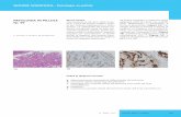 SEZIONE SCIENTIFICA - Patologia in pillole · b carcinoma adeno-squamoso del polmone c carcinoma non a piccole cellule del polmone (non small cell lung cancer/NSCLC) d metastasi ...