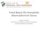 Fetal eyin Ön Kompleks Anomalilerinin Tanısı - tmftp.orgtmftp.org/webkontrol/uploads/files/BUSRANUR_CAVDARLI_1_2018.pdf · • Konjenital katarakt+, Epilepsi • 23 günlükken