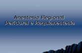 Anestesia Regional Peridural e Raquianestesia · complicaÇÕes em anestesia regional . cefalÉia pÓs-raquianestesia
