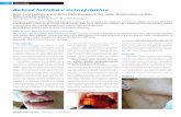 Belavé ložiská v ústnej dutine - solen.sk ?· 178 Dermatológia pre prax | 2011; 5(4) | Kazuistiky…