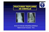 FRACTURES TRIPLANES DE CHEVILLE Fracture de lÕEI du tibia associant une fracture m taphysaire et une fracture piphysaire = type 4 de Salter et Harris - Le trait passe dans les 3 plans