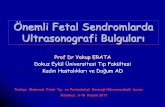 Önemli Fetal Sendromlarda - tmftp.orgtmftp.org/webkontrol/uploads/files/YAKUP ERATA10Kasım.pdf · Major anomaliler tüm doğumların %3ü bilinmeyen % 50 monogenik % 8 kromozomal