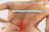 FRATURAS VERTEBRAIS - spine.pt · CIFOPLASTIA COM BALÃO OU COM STENT ... anestesia local de acordo com a recomendação do ... Deeg DJ, Lips P. Consequences of vertebral deformities