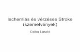 Ischemiás és vérzéses Stroke (szemelvények)neurologia.med.unideb.hu/.../files/oldal/136/prof_csiba_laszlo_stroke_2013d5f3.pdf · 8 559 férfi nő 10 380 Agyi keringészavar (stroke)