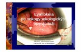 Lymfokéla po onkogynekologických operáciách - i-med.sk · USG CT tenkoihlová aspirácia tekutiny na cytologické, biochemické a kultiva čné vyšetrenie intravenózna urografia