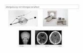Bildgebung mit Röntgenstrahlen - Epileptologie · Projektions-Radiographie Computer-Tomographie (Bildernachweis: Dössel, 2000; Morneburg, 1995; Kalender, 2000; Siemens, Philips,
