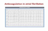 Anticoagulation in atrial fibrillation - oeige.it209:slide-7-anticoagulation-in-atrial-fibrillation.pdf · Delirium Cordis “In questa forma di aritmia i battiti cardiaci si susseguono