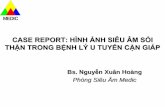 CASE REPORT: HÌNH ẢNH SIÊU ÂM SỎI THẬN TRONG BỆNH LÝ … fileCASE REPORT: HÌNH ẢNH SIÊU ÂM SỎI THẬN TRONG BỆNH LÝ U TUYẾN CẬN GIÁP Bs. Nguyễn Xuân Hoàng