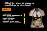 difficultés , pièges et images-clé en pathologie du tube ...onclepaul.fr/wp-content/uploads/2011/07/occlusion-colique-par-obtacle... · hernie du foramen omental (hiatus de Winslow)