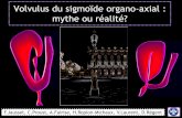 Volvulus du sigmoïde organo-axial : mythe ou réalité?onclepaul.net/wp-content/uploads/2011/07/volvulus-du-sigmoïde.pdf · Volvulus du sigmoïde organo-axial : mythe ou réalité?