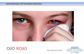 OJO ROJO EN EL NIÑO - prioridadcero.com · Diagnóstico Hemorragia Conjuntivitis Queratitis Uveítis Glaucoma agudo Causa Espontánea Conjuntivitis Traumática Bacteriana Vírica