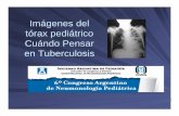Imágenes del tórax pediátrico Cuándo Pensar en Tuberculosis · diagnóstico de la TBC pulmonar en pediatría son las imágenes radiológicas. Siempre que se investigue TBC se