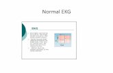 Normal EKG - cardiovascularacademy.comcardiovascularacademy.com/.../EKG_Kursu.pdf · Normal EKG Nasıl Olmalıdır ? • Kalp Hızı: 60‐100/dakika • Ritim düzenli olmalıdır