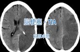 脳梗塞・ 脳梗塞TIA・非弁膜症性心房細動を持つ脳梗塞または一過性脳虚血発作（TIA）患者の再発 予防にNOACであるダビガトラン、リバーロキサバン、アピキサバン、またはワル