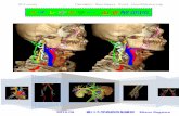 スススステテテテレレレレオオオオカカカカララ …anatomy2/bone/boneArtery.pdf③右前区域枝right anterior segmental branch ④右後区域枝right posterior
