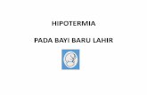 HIPOTERMIA PADA BAYI BARU LAHIR. HIPOTERMI.pdf · 2. Pengeringan bayi segera setelah lahir 3. Kontak kulit dengan kulit 4. Pemberian Air Susu Ibu 5. Menunda Memandikan & Menimbang