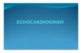 TUJUAN - pspk.fkunissula.ac.id ECHOCARDIOGRAFI.pdf · Indikasi Ekokardiografi (1) Dimensi atrium, ventrikel, aorta Fungsi & anatomi katup-katup Fungsi, gerakan, tebal dinding ventrikel
