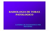 RADIOLOGIA DE TORAX PATOLOGICO Tórax... · radiologia de torax patologico catedra de diagnostico por imagenes. patologias pulmonares • opacidades • alveolares » por ocupaciÒn