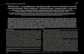 ROCK1 mediates leukocyte recruitment and neointima ...dm5migu4zj3pb.cloudfront.net/manuscripts/29000/29226/JCI0829226.v2.pdf · ROCK1 mediates leukocyte recruitment and neointima