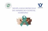 Neoplasias Benignas do Aparelho Genital Feminino (SMGA)sogima-rj.com/wp-content/uploads/2019/05/Neoplasias-Benignas-do... · LEIOMIOMA UTERINO (LM)-Neoplasia benigna do músculo liso