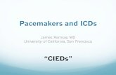 Pacemakers And ICDs Ramsay - UCSF Dept of Anesthesia...The pacemaker senses activity it interprets as cardiac in origin and is inhibited! The pacemaker senses muscle activity (“rate