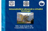 Intravaskulární ultrazvuk a virtuální histologie · Intravaskulární ultrazvuk a virtuální histologie MUDr. Tomáš Kovárník, PhD. II. Interní klinika VFN a 1. LF UK
