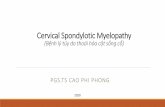 Cervical Spondylotic Myelopathythuchanhthankinh.com/userupload-thuchanhthankinh... · • Bệnh nhân cervical spondylotic myelopathy có thể bị mất cảm giác hai bên tiến