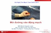 Hội Nghị Tim Mạch Toàn Quốc 2015vnha.org.vn/upload/hoinghi/hn2015/E0311-HuynhLinh.pdf · thay cho bộc lộ động mạch bằng phẫu thuật. Phương pháp Seldinger.