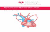 Die koronare Bypass-Operation - Schweizerische Herzstiftung€¦ · als Bypass verwendet, muss ein weiterer Hautschnitt, meistens an der Innenseite eines Unter- oder Oberschenkels,