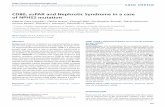 CD80, suPAR and Nephrotic Syndrome in a case of NPHS2 mutationscielo.isciii.es/pdf/nefrologia/v33n5/caso.pdf · nephrotic syndrome that frequently progresses to end-stage-renal disease.11