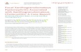 Focal Xanthogranulomatous Pyelonephritis Associated · 2020-02-04 · Focal xanthogranulomatous pyelonephritis associated with xanthogranulomatous cholecystitis in a 56-year-old man,