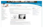 Arthritis of the Wrist - ortho4states.com · osteoarthritis and rheumatoid arthritis. Osteoarthritis Osteoarthritis (OA) is a progressive condition that destroys the smooth articular