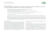 Case Report Primary Pleomorphic Adenoma of the External ...downloads.hindawi.com/journals/criot/2014/975151.pdf · Gd-enhanced Homogenic-high Homogenic-high Homogenic Homogenic Moderate