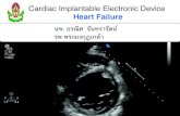 Heart Failure...PMK Cardiology Review Cardiac Implantable Electronic Device Heart Failure 1 นพ. ธรศ นทราต รพ พระมง0ฎเกา PMK Cardiology Review
