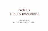 Nefritis Tubulo-Intersticial › downloads › cursos2020 › nefrologia_04.pdf · NTI Crónica - Etiología PLOMO • Exposición persistente (>60mcg/dl).NTI con deterioro lento