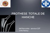 PROTHESE TOTALE DE HANCHE - onclepaul.fronclepaul.fr/wp-content/uploads/2011/07/prothèses-coxo-fémorales.… · 1970: PTH sans ciment (effet press-fit, surface lisse) 1980: PTH